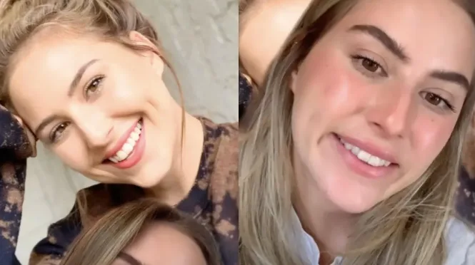 Botox mal aplicado en Medellín — caso 1, foto de referencia