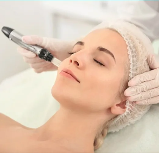 Dermapen for Melasma & Dark Spots in Medellín: Protocol 2026