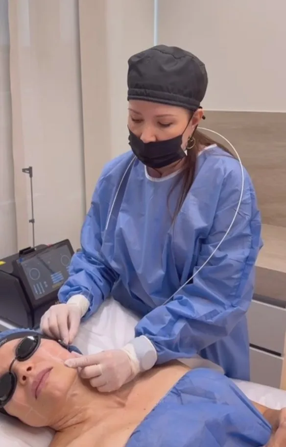 Endolifting Results: How Long Do They Last? Medellín 2025