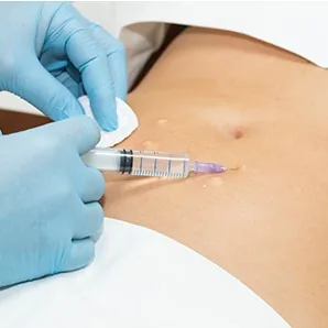 Mesoterapia Medellin