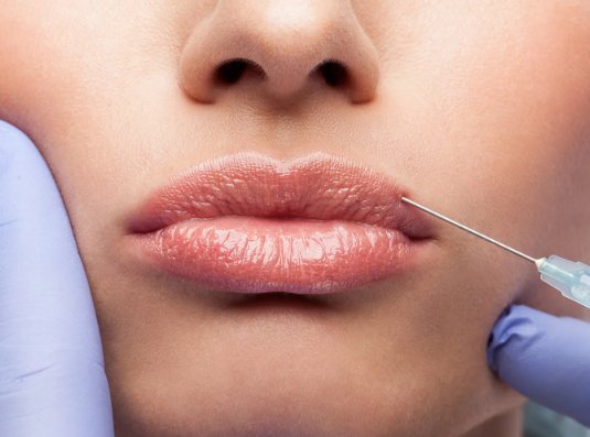 Fillers de Labios Medellin